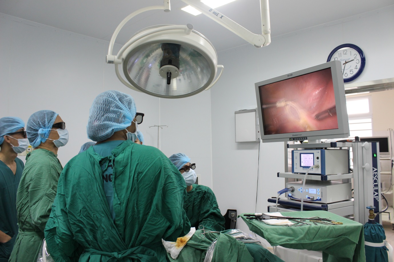 Lần đầu Tiên đưa Vào Sử Dụng Hệ Thống Máy Phẫu Thuật Nội Soi 3D Tại BVĐK Thiện Hạnh