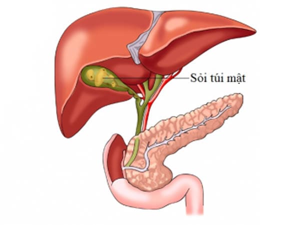 Điểm mặt nguyên nhân gây đau bụng ở người cao tuổi