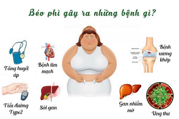 Những bệnh người béo phì dễ mắc