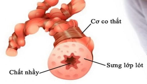 Bí quyết giúp bệnh nhân hen kiểm soát tốt bệnh trong dịch COVID-19