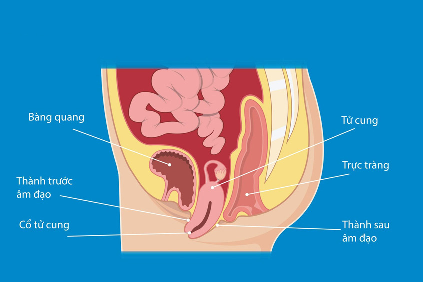 Bệnh Sa sinh dục là gì?