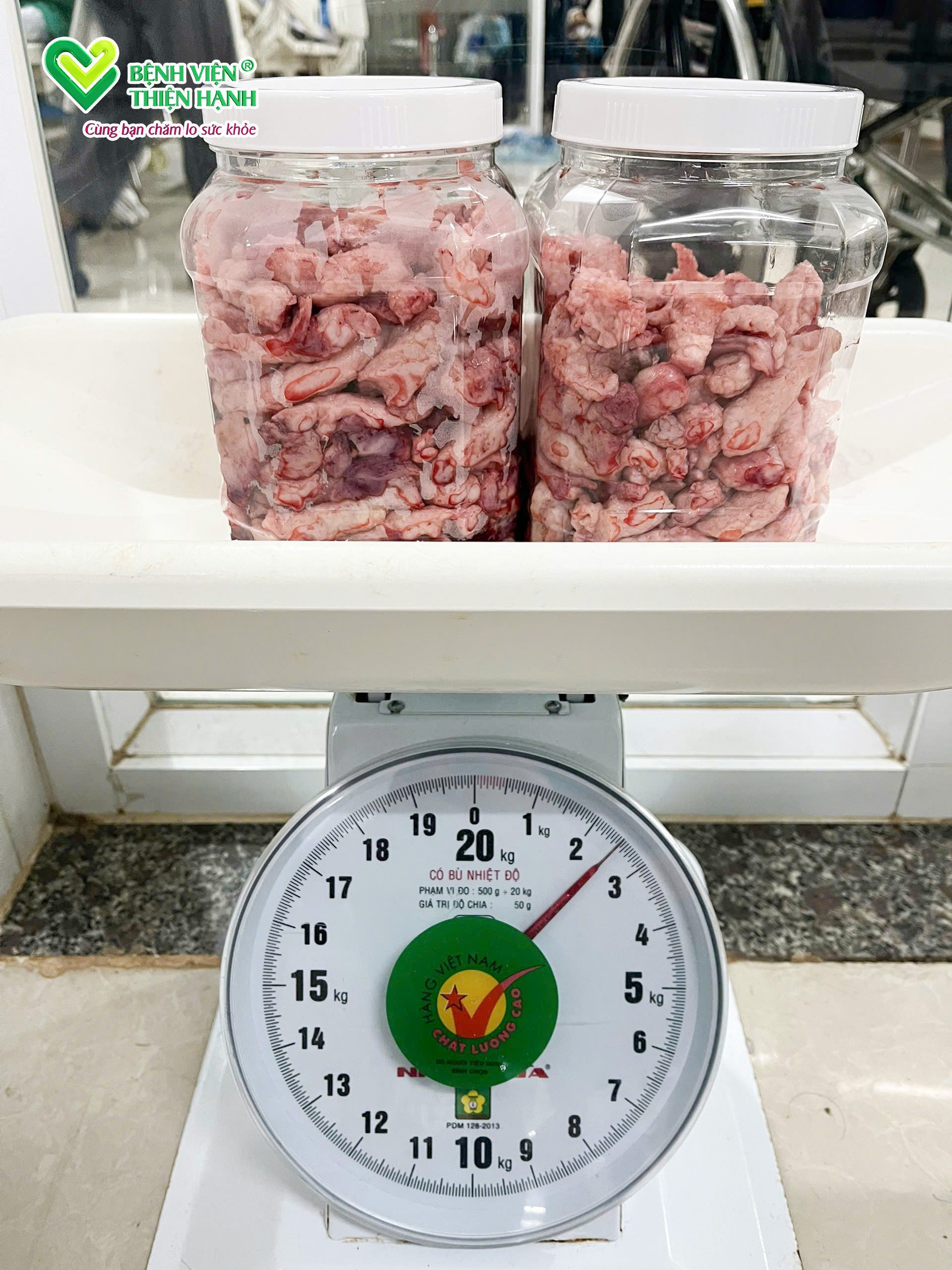 Khối u xơ tử cung sau phẫu thuật được lấy ra hoàn toàn, nặng khoảng 2,5kg